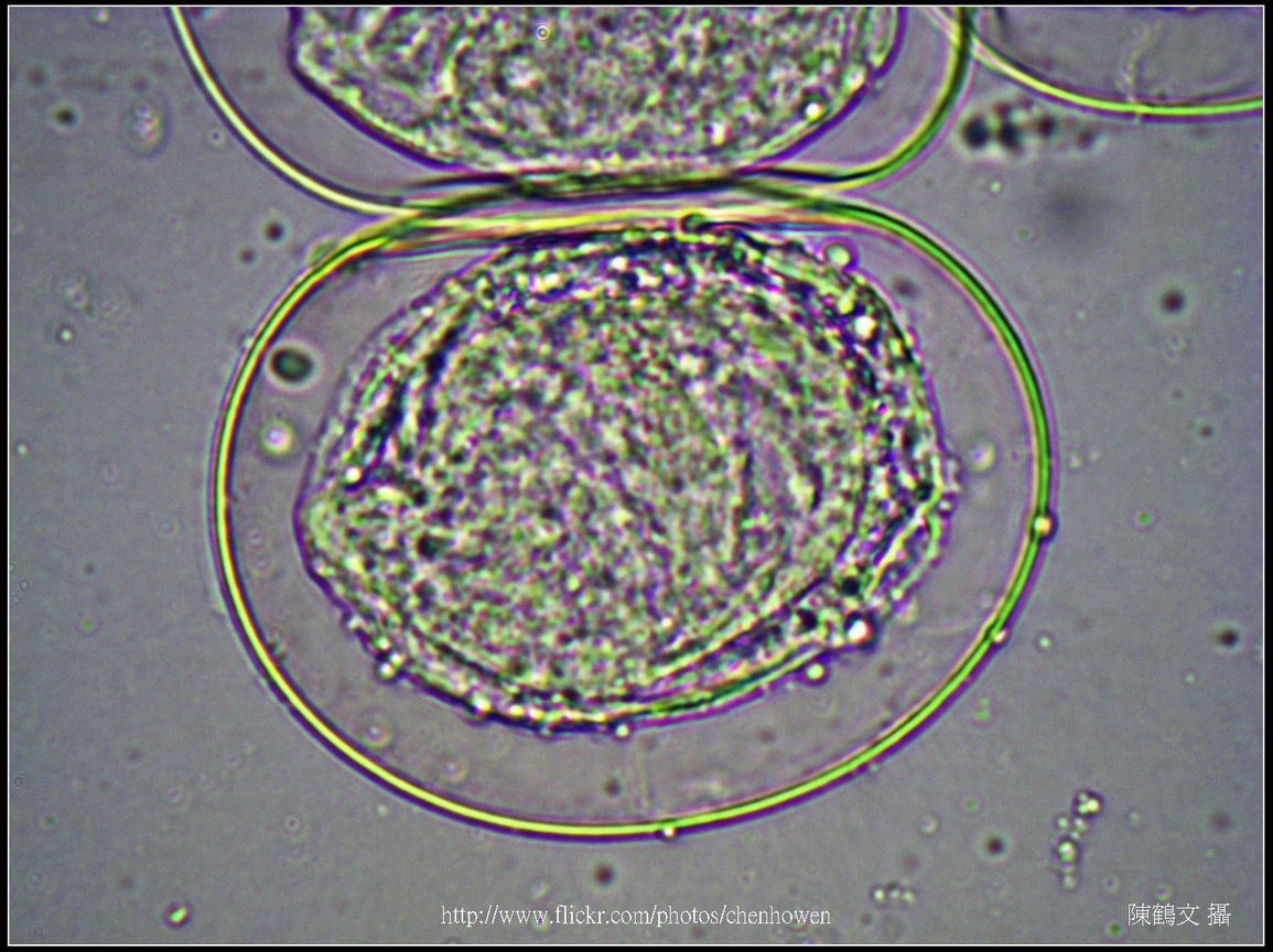 600X光學_血吸蟲 卵裝片 (生活史包括成蟲、卵、毛蚴、胞蚴、尾蚴及童蟲等6�