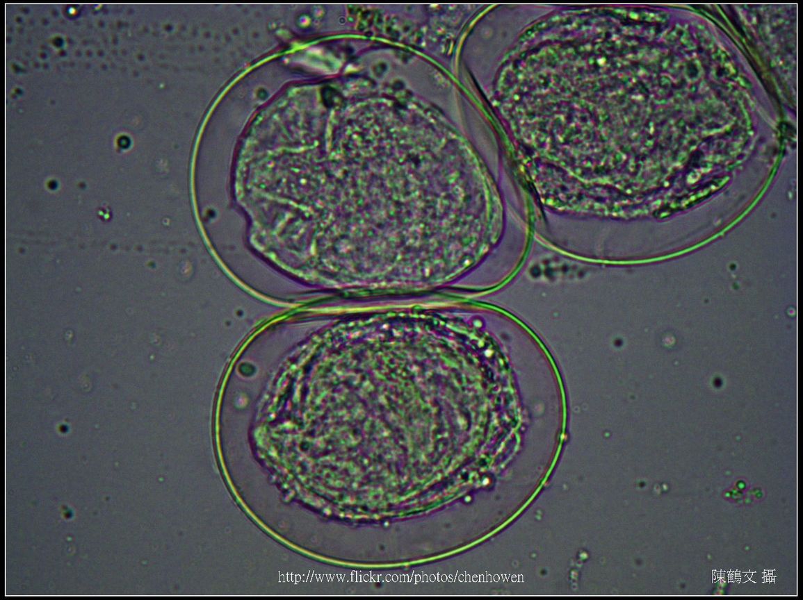 400X光學_血吸蟲 卵裝片 (生活史包括成蟲、卵、毛蚴、胞蚴、尾蚴及童蟲等6�