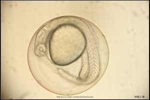 Zebrafish Embryo in pH4 media at 27 hpf_01