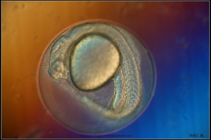 Zebrafish Embryo in pH4 media at 27 hpf_02