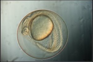 Zebrafish Embryo in pH4 media at 27 hpf_03