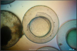 Zebrafish Embryo in pH4 media at 14 hpf _01