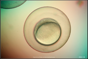 Zebrafish Embryo in pH4 media at 10.5 hpf _01