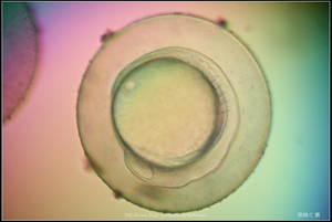 Zebrafish Embryo in pH4 media at 12 hpf _03